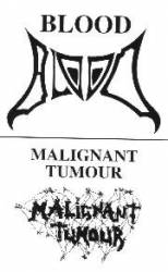 Malignant Tumour : Blood - Malignant Tumour